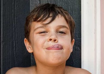 트고 갈라지는 입술…”침 바르지 마세요”