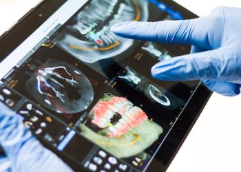 [건강]임플란트에 대한 현직 치과의사의 쓴소리