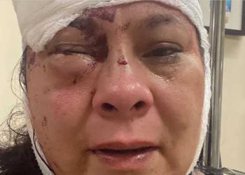 ‘크리스마스의 악몽’ 성탄 선물 살 돈 털리고 무차별 폭행 당해