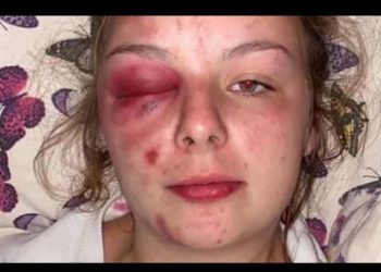 “아시아계 남성들이 성폭행했다”…자작극 밝혀져