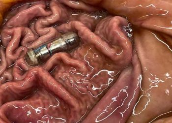 식사전 삼키면 배에서 ‘부르르’…살빼는 진동캡슐 등장