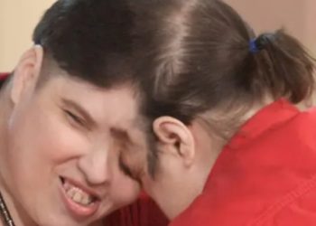 세계 최고령 샴쌍둥이 62세로 숨져…자매로 태어나 남매로