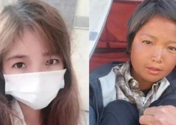 동일 인물 맞나요? … 20대 여성 3개월 만에 60대 모습 충격