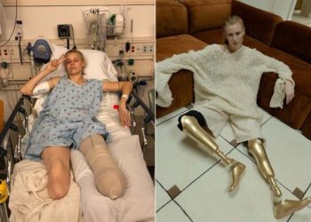 [화제] 탐폰 사용 후 다리 절단한 LA 여성, 황금의족으로 복귀