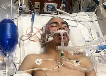 “이럴수가” 15살 생일 햄버거 먹다 무차별구타… 의식불명