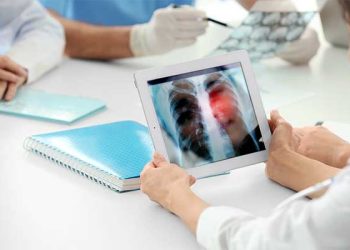 롱비치시 ‘결핵유행’, 비상사태 선포