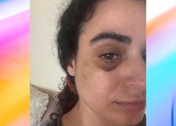 반려견 산책 LA 여성 봉변…노숙자가 이유 없이 폭행