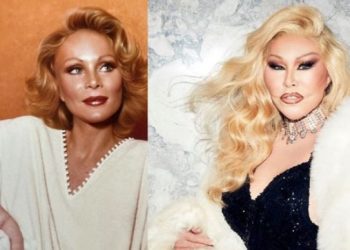 뉴욕 사교계 유명 여성, 성형 전후 충격사진 공개