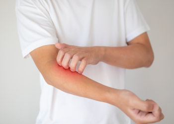 “참을 수 없는 괴로움”…’긁적긁적’ 가려움증 탈출법은?