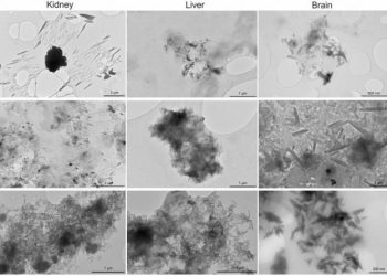 “미세 플라스틱, 인간 뇌에 쌓인다” … 뇌중량의 0.5% 플라스틱