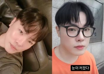 성형설 휘성, “17㎏ 감량…눈이 커졌다”
