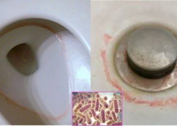 무심코 지나친 욕실 분홍색 ‘때’ … 치명적 박테리아