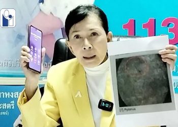 18년간 하복부 통증…의사가 떨어뜨린 ‘주삿바늘’ 때문