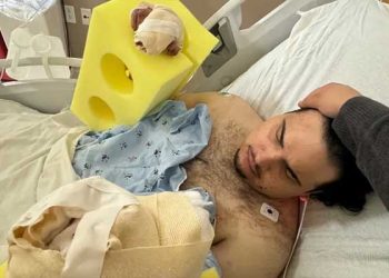 다저스 우승 폭죽놀이 남성, 손가락 2개 절단