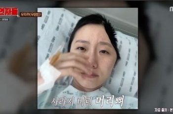 승무원 출신 우자까, 머리뼈 40% 제거