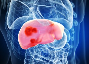 “간경화 더이상 사형선고 아니다”