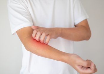 20·30세대, 매독 환자 급증 …일본, 미국, 한국서 확산