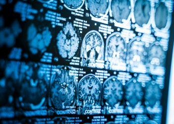 해외여행 30대 미 여성 …’이것’ 먹었다 뇌에 기생충 감염