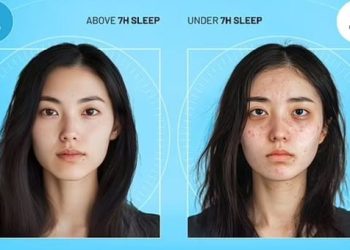 잠 못 드는 당신 얼굴 이렇게 된다… 수면부족의 결과는?