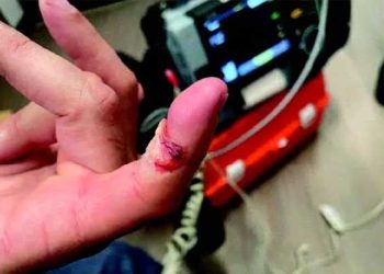 ICE에 격렬 저항, 손가락 깨물어 골절 … 법원출석 했다 체포돼