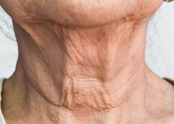 주름·흰머리 없애는 비법 나왔다…독일 연구팀 발견