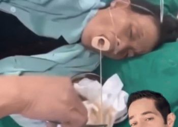 돼지고기 먹은 여성 입에서 끝없이 나오는 촌충(영상)