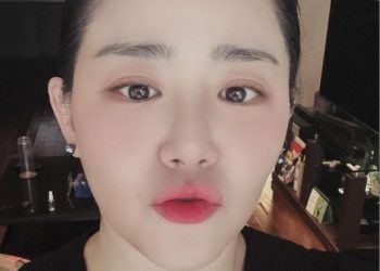 ‘희소병 완치’ 문근영, 다이어트 성공…”더 예뻐졌네”