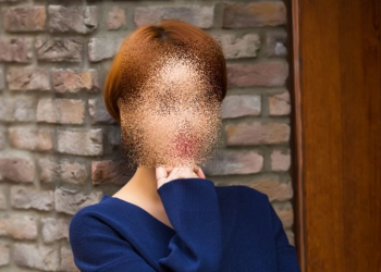 ‘신사의 품격’ 여배우 시술받다 화상…5천만원 배상