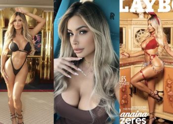 “여권사진과 딴판”…100만달러 성형모델, 미국 입국 제지