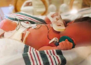 아파트 쓰레기통에 버려진 신생아 발견 … “산모를 찾아라”