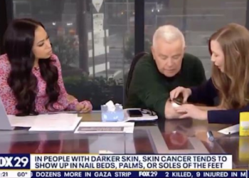 “이거 암이네요”…생방송 중 피부암 진단받은 앵커