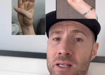 “엄지손가락 접어보세요”…심장질환 확인 ‘1분 자가진단법’ 화제