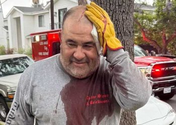 ‘빈집 점거’ 노숙자, 이유 없이 무차별 폭행… “살아 있는 악몽”