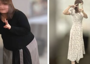 “살아 있기만 해도 살 빠져”…49㎏뺀 다이어트 비결은?