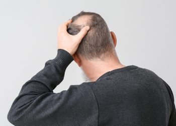 탈모 정복 임박?…쥐 실험 20일 만에 새 털 확인