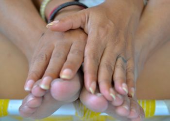 “손발 부종, 알레르기인줄”…진단만 8년 걸리는 ‘이 질환’