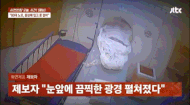 CT 촬영 중 팔 ‘빨려 들어가’ 중태…끔찍한 상황