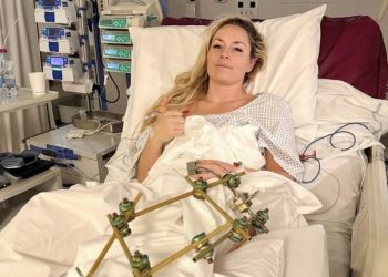 13초 만의 비극…’스키 여제’ 린지 본 ‘다리 절단’ 기로