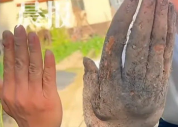 “시신인 줄 알았네”…사람 손처럼 자란 ‘이것’ 화제