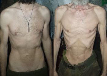 보급 끊긴 우크라이나 최전방 부대… 충격적 ‘기아 병사’ 사진