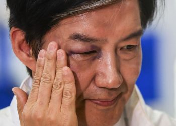 눈에 시퍼렇게 멍든 조국… 무슨 일?