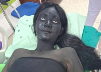 “귀신인 줄 알고 깜짝”…온몸 새까매진 16세 여학생의 정체는