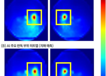 “치매, 망막 사진 한장으로 선별”…’AI모델’ 개발